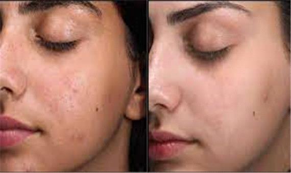 چگونه پوست خود را زیبا نگه داریم؟