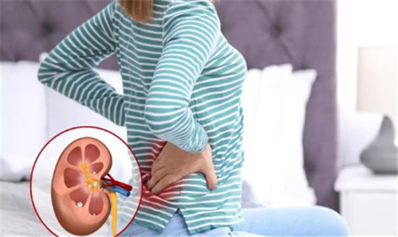 4 نکته برای ورزش کردن با سنگ کلیه