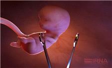پزشکی قانونی مازندران نسبت به دور زدن قانون سقط جنین هشدار داد