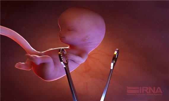 پزشکی قانونی مازندران نسبت به دور زدن قانون سقط جنین هشدار داد