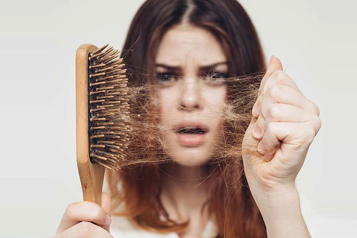شایع‌ترین علت ریزش مو در خانم‌ها و آقایان ارث است