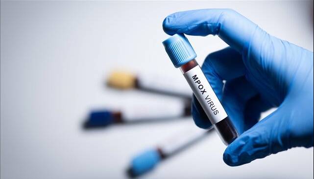 سازمان جهانی بهداشت: «ام پاکس» در کشورهای بیشتری شناسایی شده است