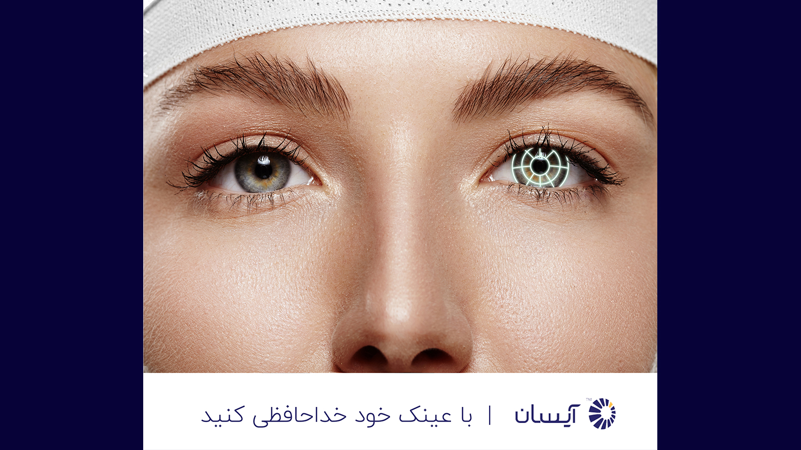 حذف عینک با پیشرفته‌ترین تکنولوژی روز دنیا