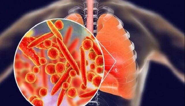 بیماری انسدادی مزمن ریه چهارمین علت مرگ‌ومیر جهان است