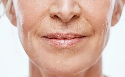 تکنیک‌های جدیدی که برای از بین بردن چین و چروک صورت استفاده می‌شود