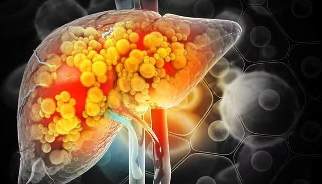 مصرف خودسرانه داروها از عوامل مهم آسیب به کبد